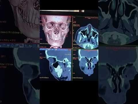 3D face Transformation