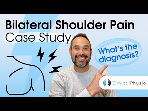 Bilateral Shoulder Pain Case Study | Expert Physio explains assessment, diagnosis and treatment!