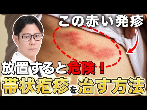 Causes and Treatment of Shingles: Explained by a Japanese Dermatologist