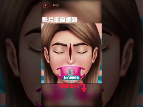 #POV #醫美話術-16 #隆鼻 竟有開眼頭的效果？醫學 #最新 的 #技術 ？！