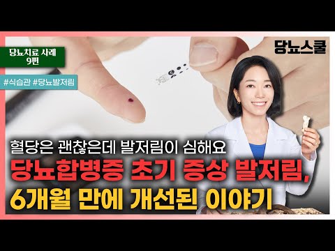 [당뇨치료 사례 9편] 혈당은 낮아도 잡히지 않던 당뇨발저림, 한약치료로 극복 가능했습니다! | 당뇨문의 : 1644-5178