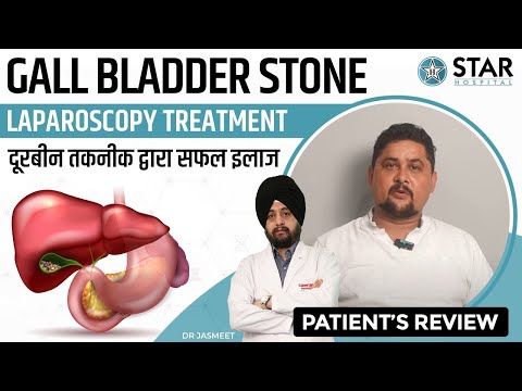 Best Hospital for Gall Bladder Stone in Nawanshahr | Best Gall Bladder Doctor |GallBladder Treatment