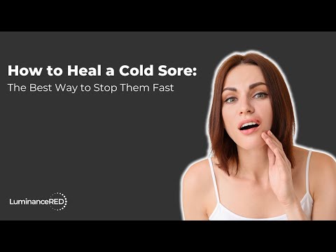 How to Heal a Cold Sore: The Best Way to Stop Them Fast