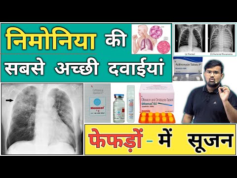 Pneumonia - निमोनिया का इलाज | Medicine | Treatment | Doctor | Pharmacy | Hospital | Nursing | MBBS