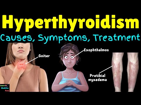 Hyperthyroidism (Overactive Thyroid): Causes, Symptoms, Diagnosis, Treatment, Complications