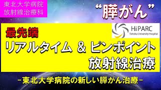 膵臓癌に対するピンポイント放射線治療