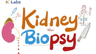 Kidney Biopsy (Taking a Sample of the Kidney) - Nephrology Labs