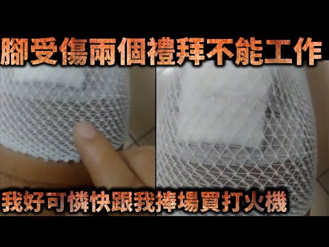 天峰抖音直播-腳受傷兩個禮拜不能工作 我好可憐快跟我捧場買打火機【冬星娛樂】