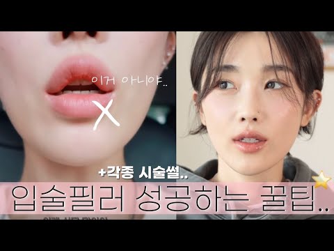 백만원 태운 얼태기 극복주간🧚🏻‍♀️feat.입술필러 성공하는 꿀팁⭐️(보톡스, 슈링크 유니버스, 백옥주사, 토닝, 홈케어...)