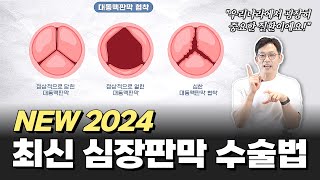 대동맥판막협착술의 최신 소식(TAVI/TAVR) | 분당서울대병원 강시혁 교수