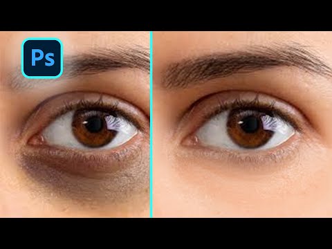 Photoshop tips 2025: How to remove dark circles in #adobe #photoshop | Tutorial | 1-Minute