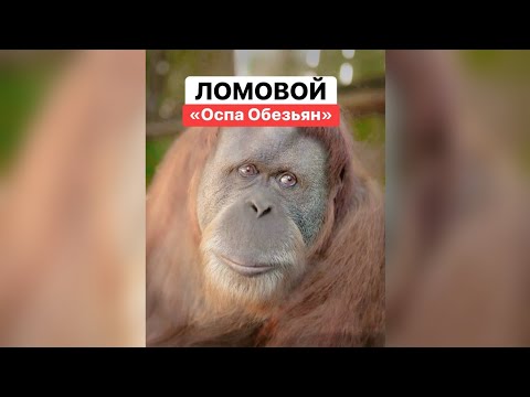 ЛОМОВОЙ - Оспа обезьян