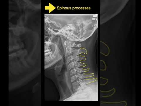 Cervical XRAY Short PartA #shorts