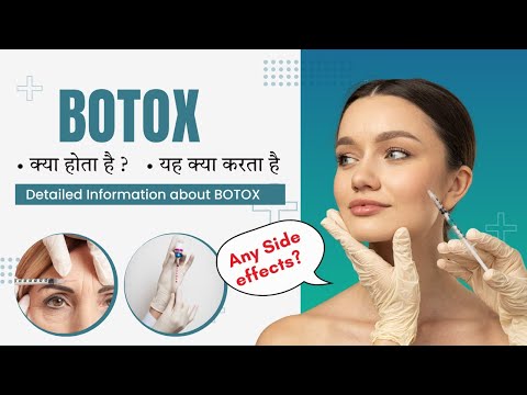 Botox क्या होता है और यह क्या करता है  | Is It Safe or Not? | Detailed Information You Need to Know