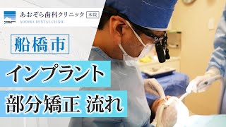 船橋市で選ぶなら、部分矯正のプロ｜あおぞら歯科クリニックのインビザライン治療と流れ