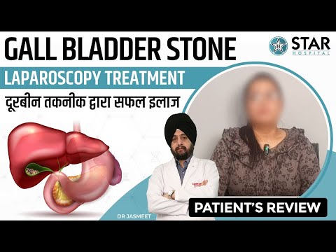 Best Hospital for Gall Bladder Stone in Ludhiana | Best Gall Bladder Doctor | Gall Bladder Treatment