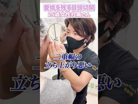 【25歳女性SBC社員】愛嬌を残す目頭切開！#shorts