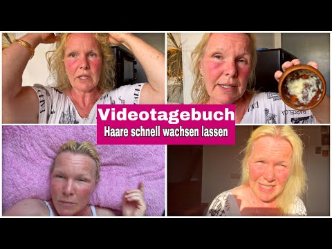 Haare wachsen lassen mit Knoblauch Tag #20| Videotagebuch | Vom Experten persönlich abgemischt