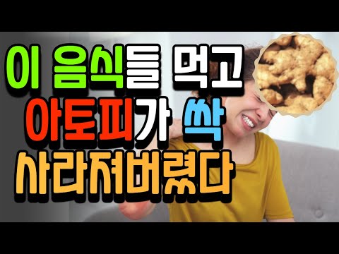 이 음식들 먹으면 골칫덩이 아토피 씻은 듯이 사라집니다. 아토피에좋은음식