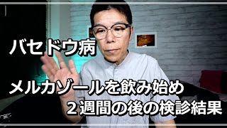 バセドウ病  メルカゾール飲み始めて２週間