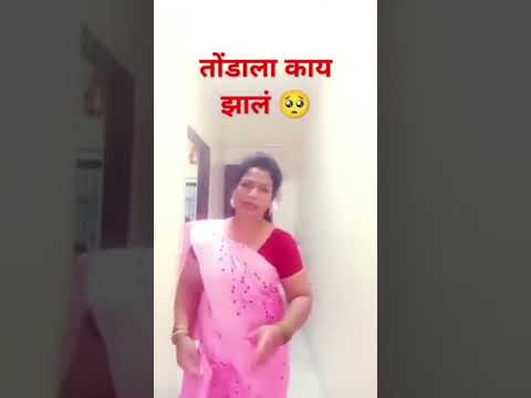 तोंडाला काय झालं 🥺#marathicomedytadka#comedyvideos#funnymarathicomedy#shorts#ytshors#viralshort#funn