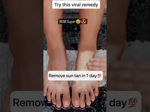 #BestWayToRemoveTanningFromHandsAndFeet #InstantFeetWhitening #youtubeshorts#shortvideo#shortsvideo