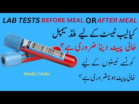 Lab Tests: Avoid These Mistakes! | Best Time for Giving Blood Sample for Tests #drabbasofficial #lab