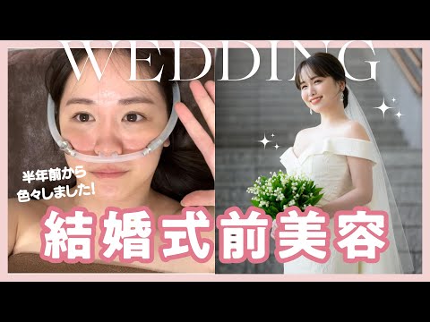 【本気美容】結婚式の半年前から綺麗になる為、本気出しました...♡！！