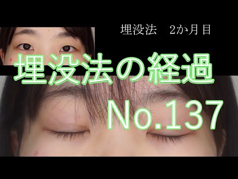 埋没法　137　#short