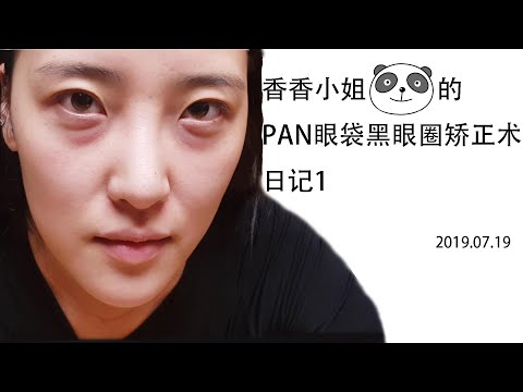 香香小姐的黑眼圈矯正日記1.請通過視頻確認PAN眼袋黑眼圈矯正術的手術場面