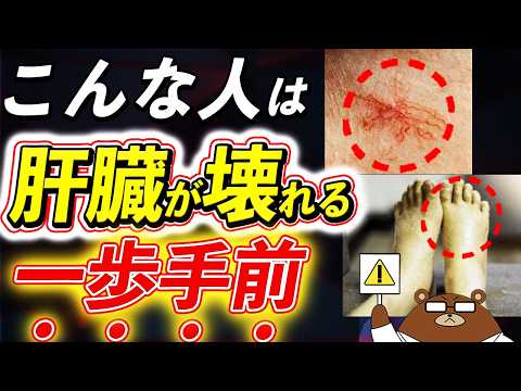 【危険】肝臓からの超意外なSOSを絶対見逃さないで！爪、皮ふ、足..肝臓が壊れる寸前のサインとは。「肝硬変」とは何か？肝臓病の予防法とは？医師が徹底解説！