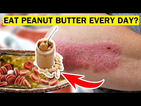 5 Advantages of Eating Peanut Butter | Peanut Butter Good for You.