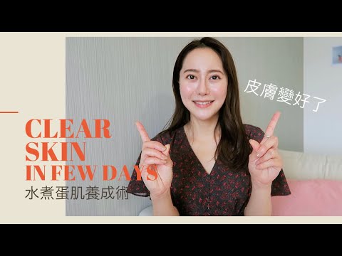 【保養秘訣】敏感痘痘肌保養分享 | 抗痘成功｜水煮蛋肌養成｜真心推薦❤️