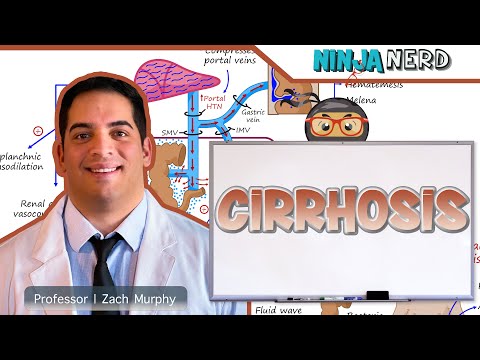 Cirrhosis | Clinical Medicine