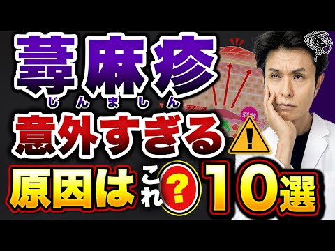 蕁麻疹の意外な原因トップ10 【治療、予防、対策など徹底解説】