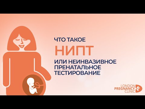 Что такое NIPT - Неинвазивный Пренатальной Тест