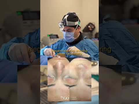 Behind the Scenes: A Day in Rhinoplasty Surgery with Assoc. Prof. Dr. Güncel Öztürk