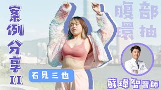 【腹部環抽】抽脂痛不痛？真實抽脂案例說給你聽(下)－蘇瑋智醫師.Feat.石見三也