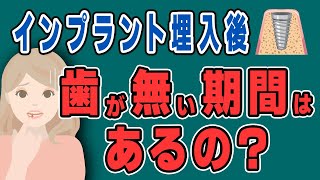 インプラント治療で歯がない期間はどのくらいある？【仮歯】