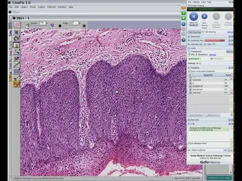 Medical School Pathology 2012 Session 065 Female Genital Tract Lab.mp4