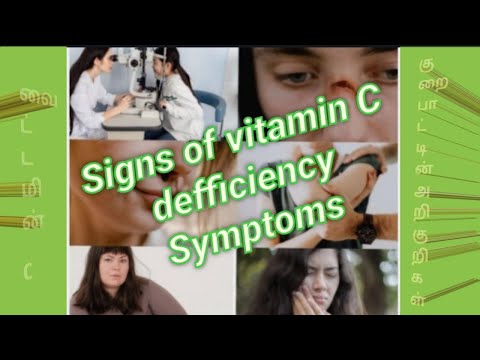 Signs of vitamin C defficiency Symptoms / வைட்டமின் சி குறைபாட்டின் அறிகுறிகள் #healthtips