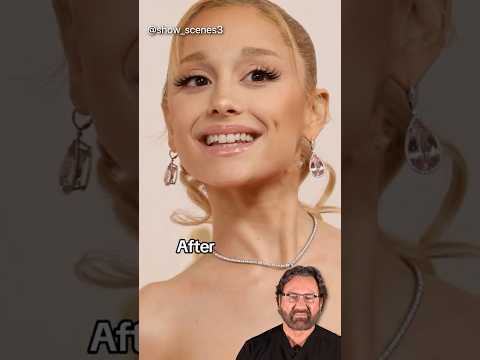 Celebrities Before & After Plastic Surgery - Surgeon Reacts