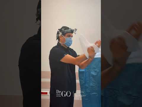 Behind the Scenes: A Day in Rhinoplasty Surgery with Assoc. Prof. Dr. Güncel Öztürk