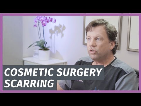 Cosmetic Surgery Scarring - Is It Worth The Trade Off?