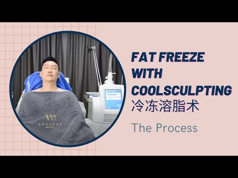 Fat Freeze with CoolSculpting | The Process