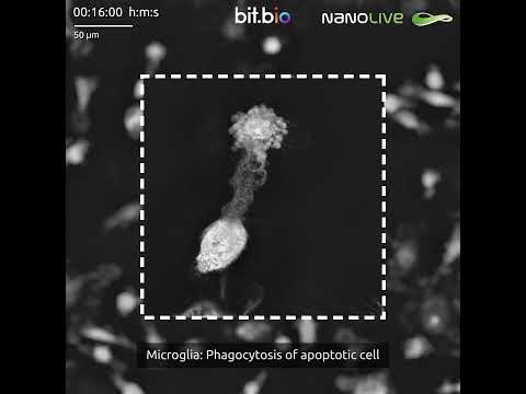 Dynamic microglia