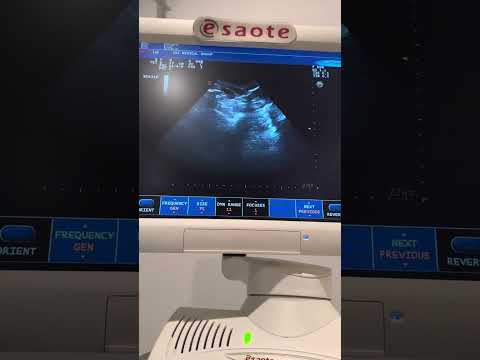 French Bulldog Pregnancy Ultrasound 27 Days. A lot of MAGIC, How many PUPPIES do you see?