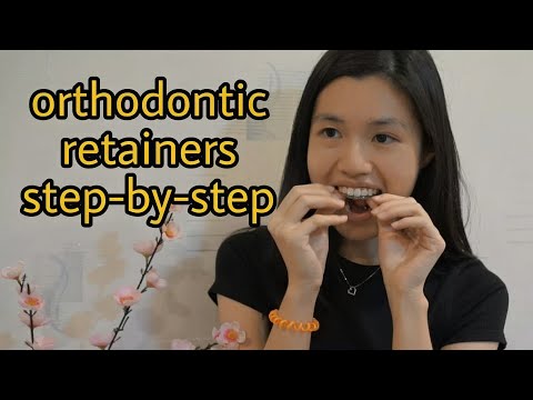 How Orthodontic Retainers Are Made