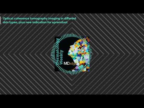 Optical coherence tomography imaging in different skin types, plus new indication for apremilast
