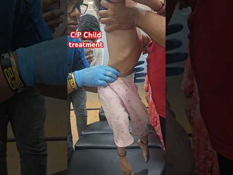 C.P Child treatment #drrajneeshkant #chiropractor #worldfamouschiropractor